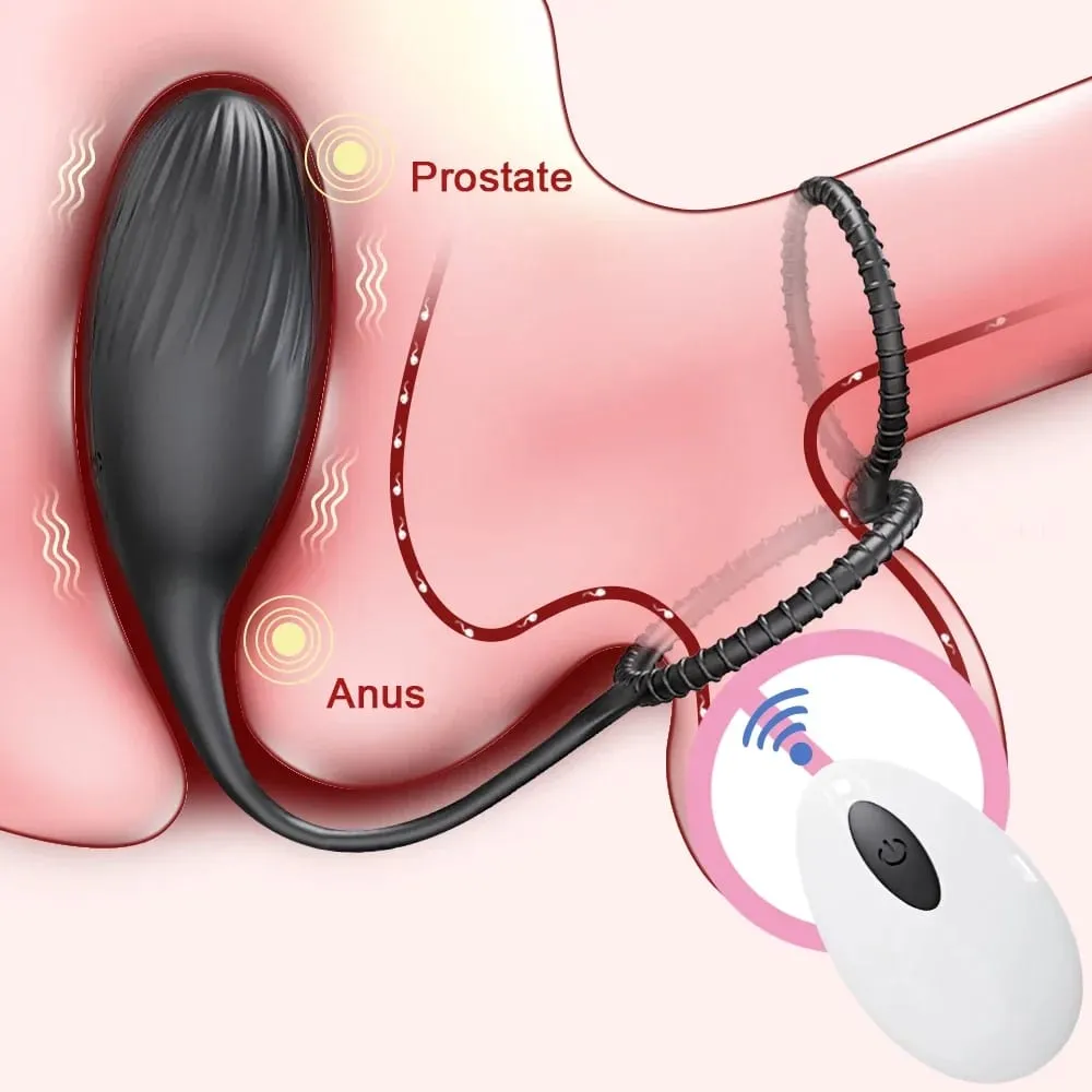 Vibrating Anal Vibrator Prostate Massager Anal Plug Cock Ring for Men Butt Plug for Gay Penis Ring Sex Toy for Male — image 1