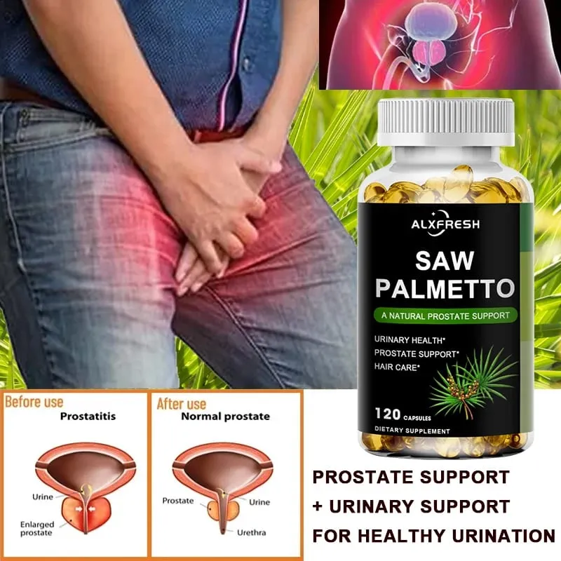 Alxfresh Saw Palmetto Supports Antioxidant Function Prostate Function and Urinary Tract Health to Support Men Health Hair Growth
