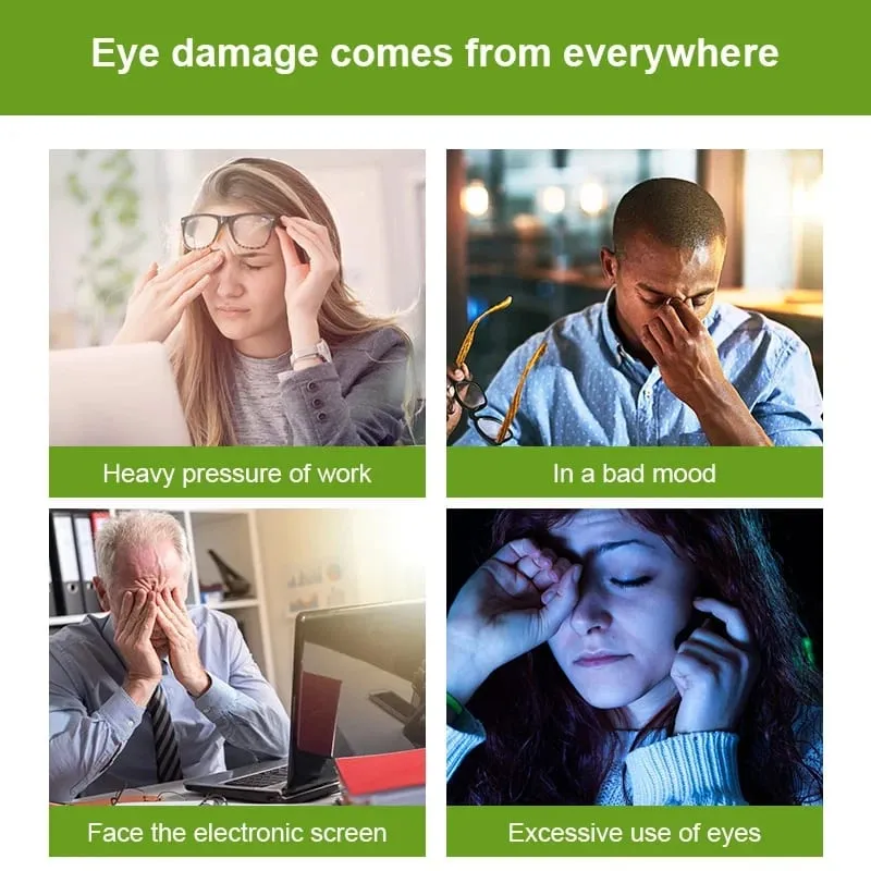 Lutein Eye Supplement - Containing Vitamins Zeaxanthin Extract Improve Eye Edema Improve Vision Health Eye Health